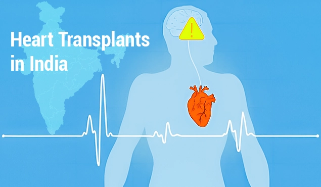 Heart Transplants in India