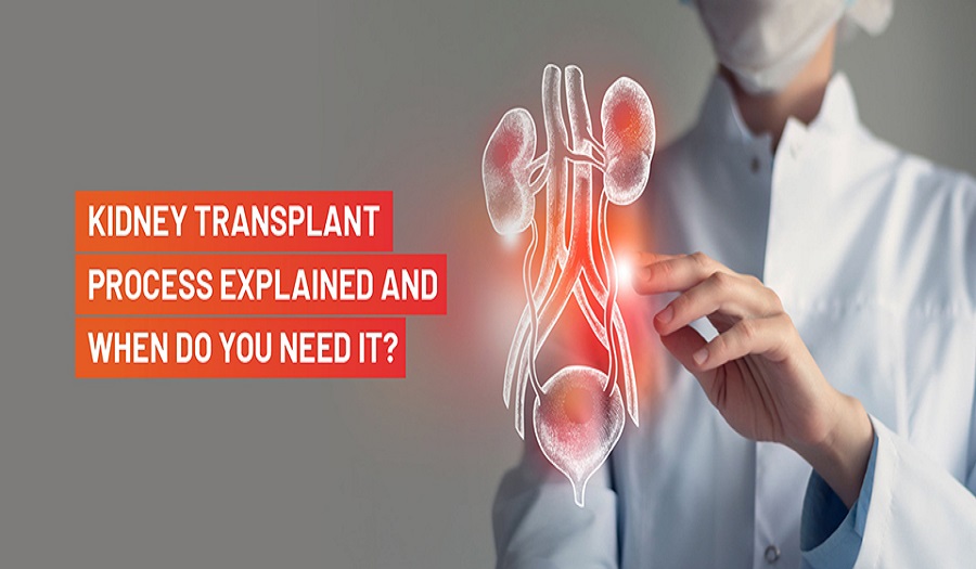 Kidney Transplants in India