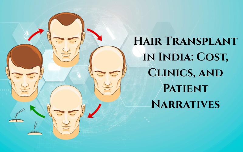 Hair Transplant in India: Cost, Clinics, and Patient Narratives