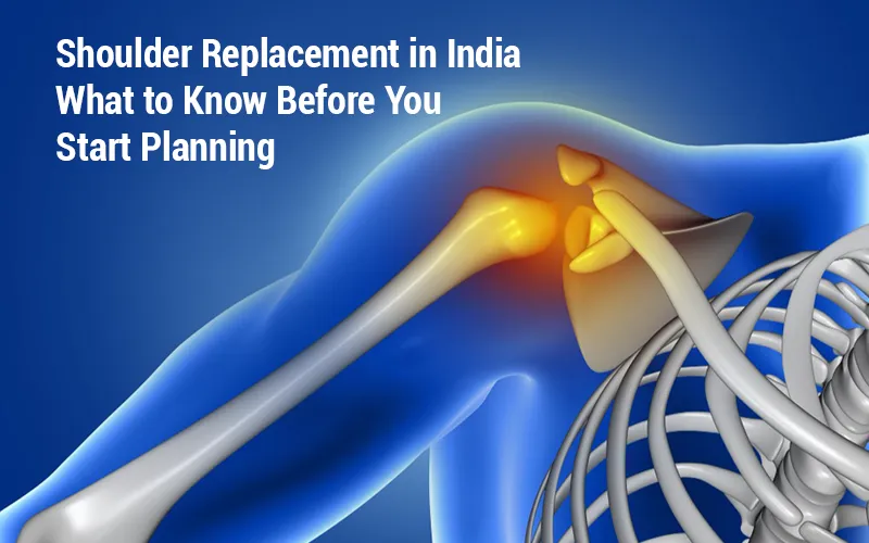Shoulder Replacement in India: What to Know Before You Start Planning