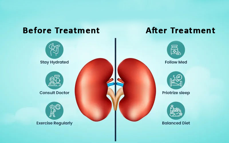 keep-your-kidney-strong-before-and-after-medical-treatment
