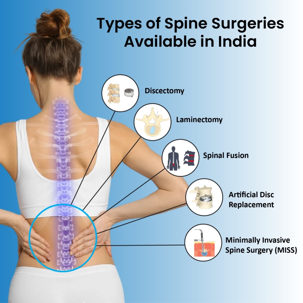 Types of Spine Surgery Available in India