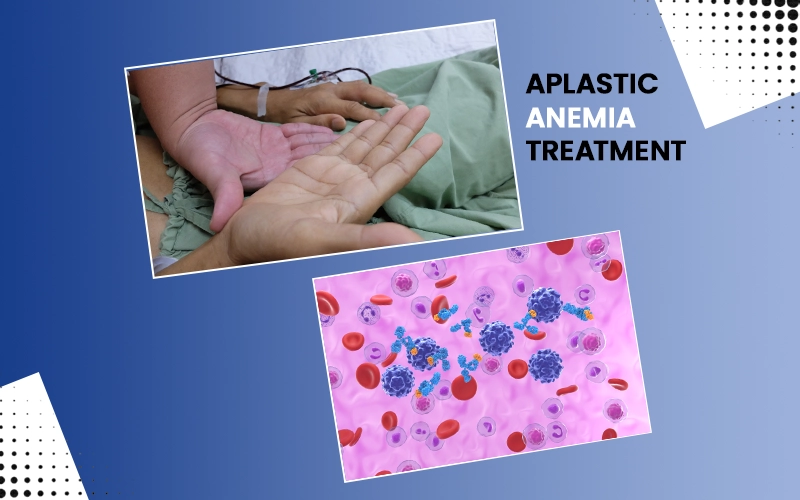 Is Aplastic Anemia Treatable Abroad? Why Many Patients Seek Advanced Care in India