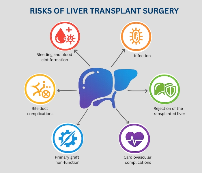 Liver Transplant Surgery