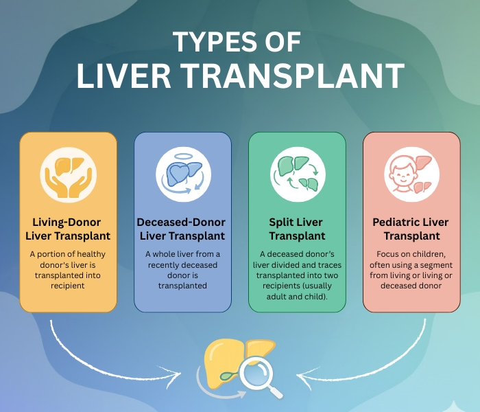 Liver Transplant Cost in India