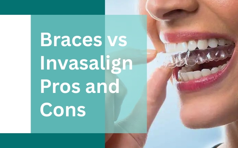 The Pros and Cons of Invisalign: Is It Right for You?