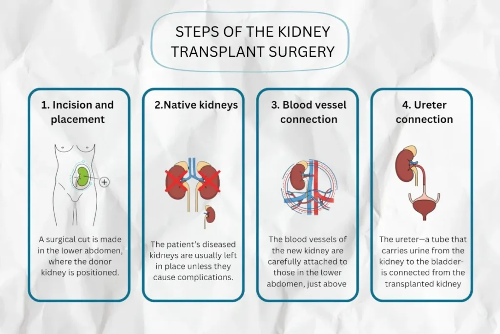 steps of the kidney transplant surgery in india