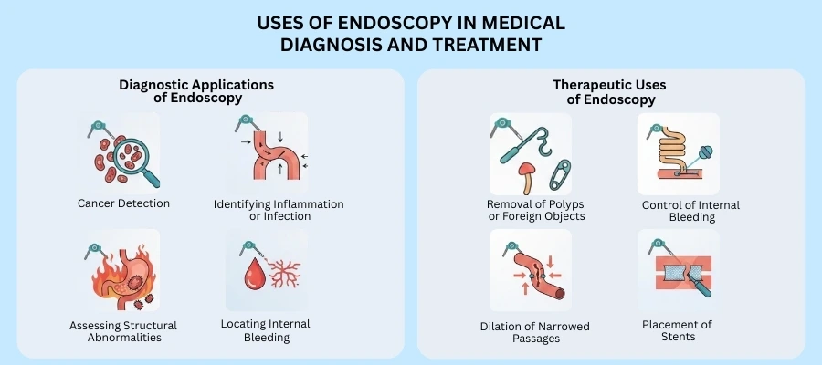 Uses of Endoscopy in Medical Diagnosis and Treatment