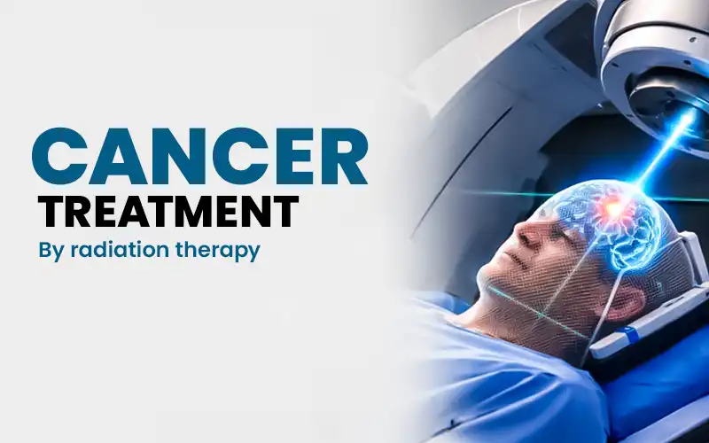Cancer Radiation Therapy in India: A Guide for Kazakhstan Patients