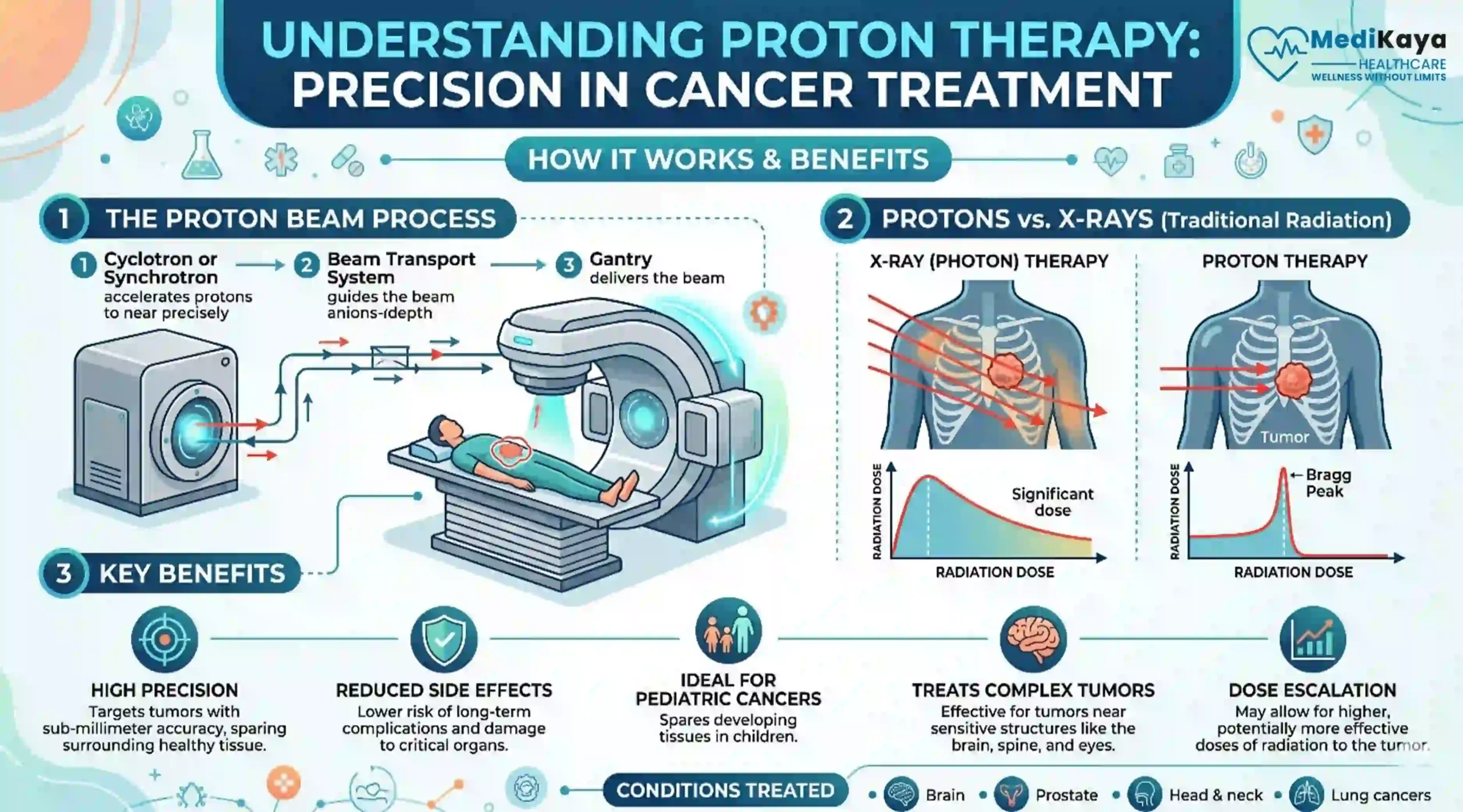 proton therapy procedure