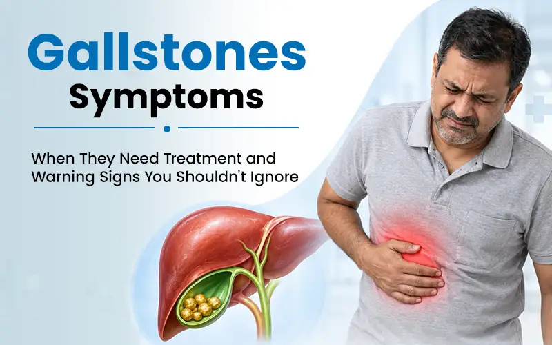 Gallstones Symptoms: When They Need Treatment and Warning Signs You Shouldn’t Ignore